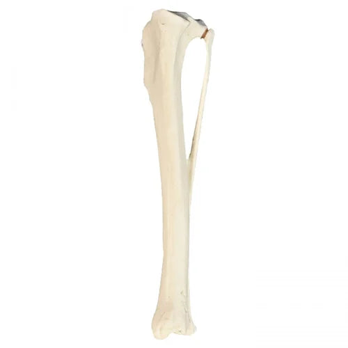 KKI210ESP Right Tibia Canine With Fibula, Med. Canal And Canc. Material