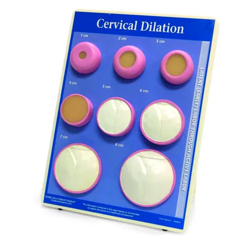 KKI-Cervical Dilation Model