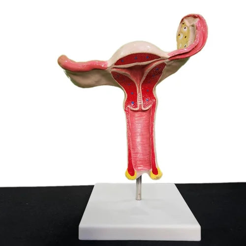 KKI-436 A Magnified Uterus Model