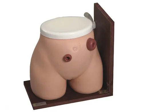 Ostomy Nursing Model