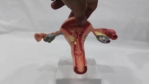 Pathological Uterus Model