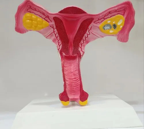 Plastic Uterus Model