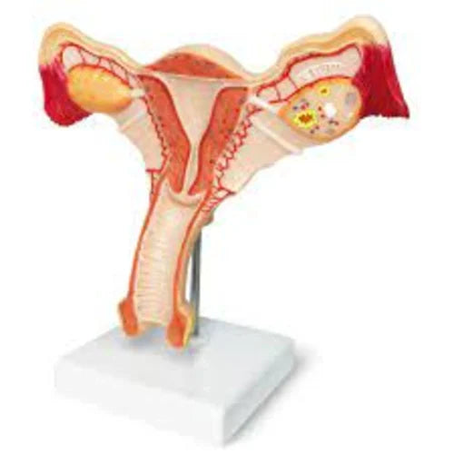 Uterus Ovary Model